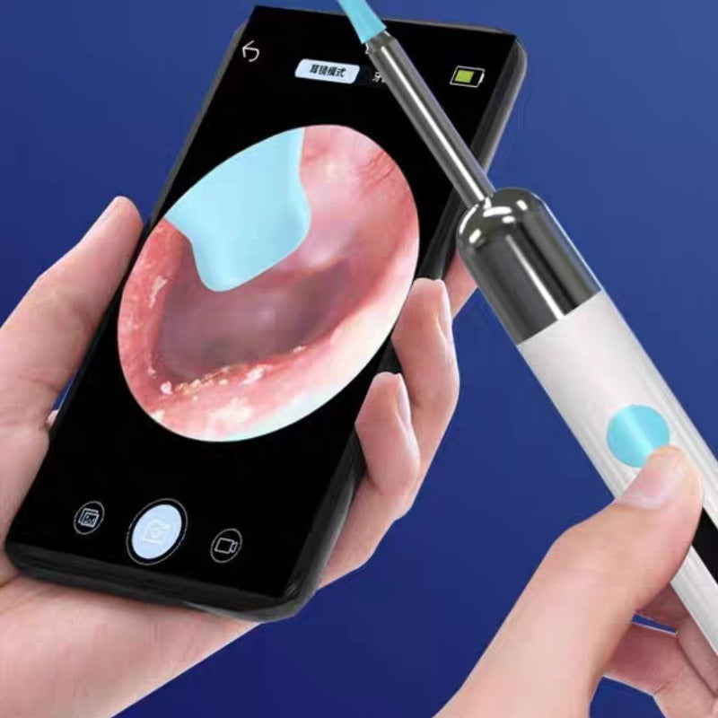 SmartScan Wireless Ear Cleaner with Camera Wireless Otoscope 1080P HD Camera Ear Wax Removal Kit