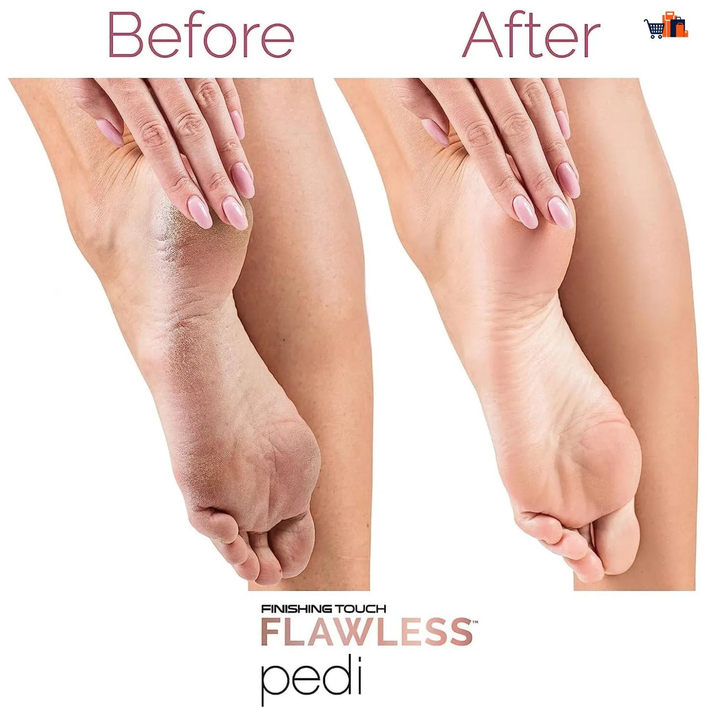 Electric Foot Callus Remover for Feet - Foot Scrubber for Dead Skin - Rechargeable Pedicure Tool Callus Remover for Feet Electronic Foot File - Feet Care for Removes Dry Hard and Dead Skin Ideal Gift