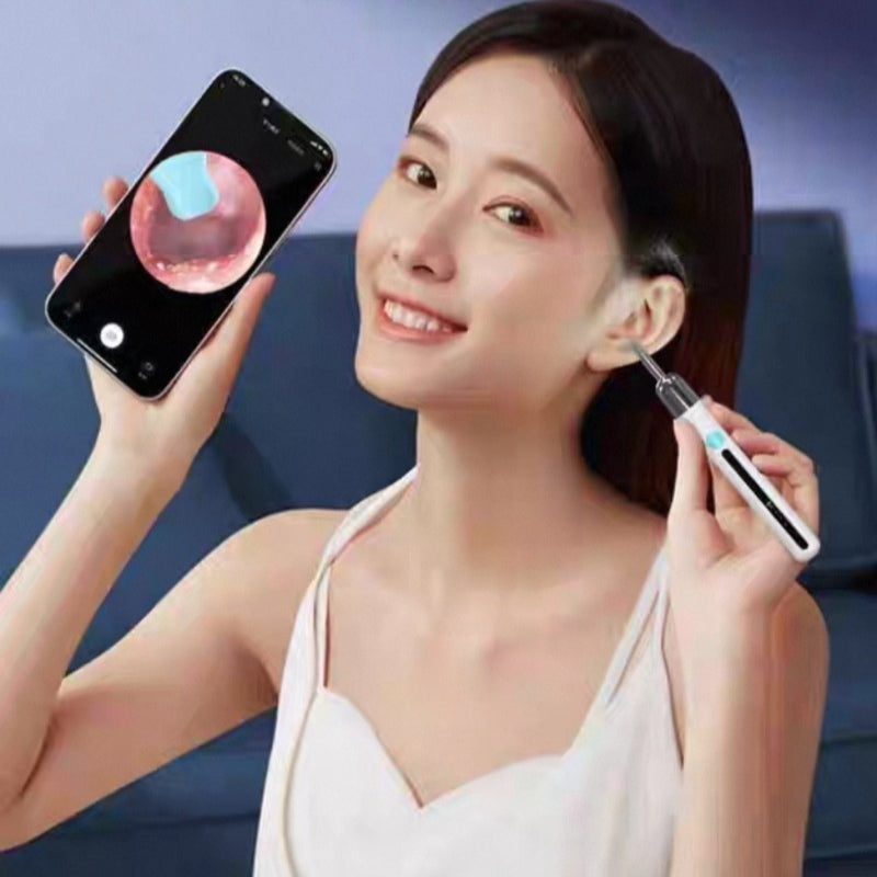 SmartScan Wireless Ear Cleaner with Camera Wireless Otoscope 1080P HD Camera Ear Wax Removal Kit